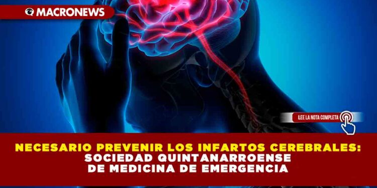 NECESARIO PREVENIR LOS INFARTOS CEREBRALES: SOCIEDAD QUINTANARROENSE DE MEDICINA DE EMERGENCIA