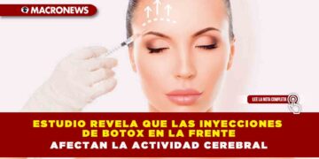 Estudio revela que las inyecciones de botox en la frente afectan la actividad cerebral