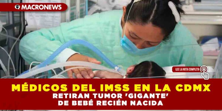 Médicos del IMSS en la CDMX retiran tumor ‘gigante’ de bebé recién nacida