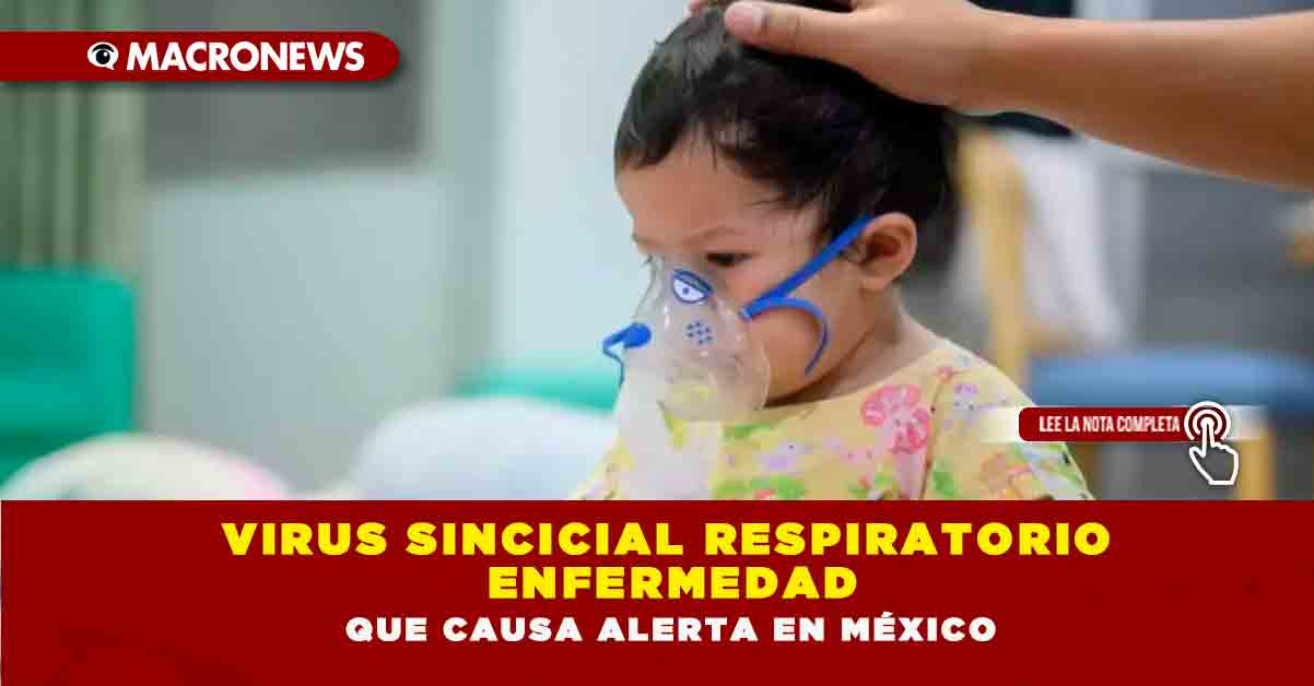 Virus Sincicial Respiratorio Enfermedad Que Causa Alerta En México