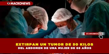 EXTIRPAN UN TUMOR DE 50 KILOS DEL ABDOMEN DE UNA MUJER DE 66 AÑOS