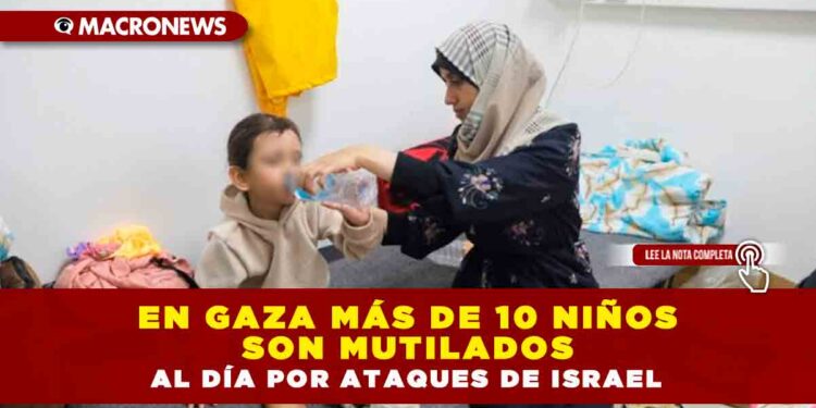 EN GAZA MÁS DE 10 NIÑOS SON MUTILADOS AL DÍA POR ATAQUES DE ISRAEL
