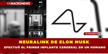 NEURALINK DE ELON MUSK EFECTUÓ EL PRIMER IMPLANTE CEREBRAL EN UN HUMANO