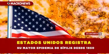 ESTADOS UNIDOS REGISTRA SU MAYOR EPIDEMIA DE SÍFILIS DESDE 1950