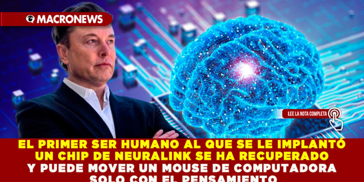 EL PRIMER SER HUMANO AL QUE SE LE IMPLANTÓ UN CHIP DE NEURALINK SE HA RECUPERADO Y PUEDE MOVER UN MOUSE DE COMPUTADORA SOLO CON EL PENSAMIENTO