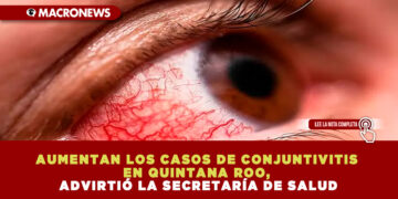 AUMENTAN LOS CASOS DE CONJUNTIVITIS EN QUINTANA ROO, ADVIRTIÓ LA SECRETARÍA DE SALUD