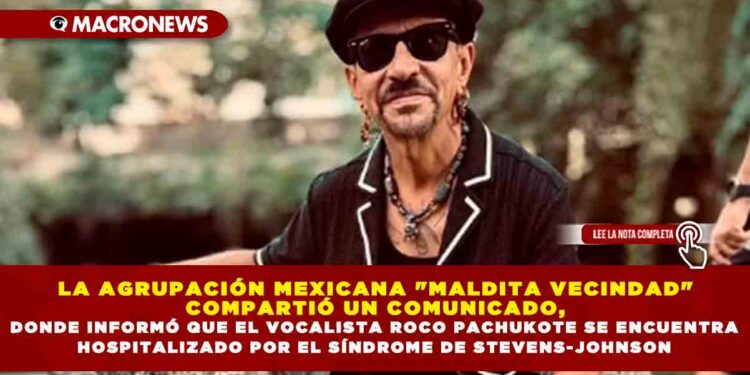 LA AGRUPACIÓN MEXICANA «MALDITA VECINDAD» COMPARTIÓ UN COMUNICADO, DONDE INFORMÓ QUE EL VOCALISTA ROCO PACHUKOTE SE ENCUENTRA HOSPITALIZADO POR EL SÍNDROME DE STEVENS-JOHNSON