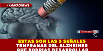 ESTAS SON LAS 5 SEÑALES TEMPRANAS DEL ALZHEIMER QUE PODRÍAS DESARROLLAR