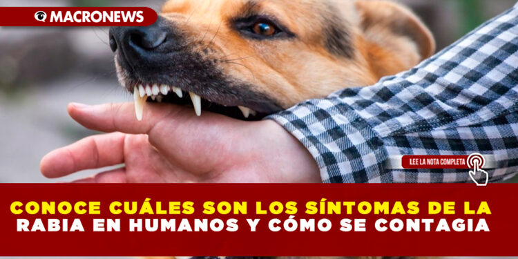 CONOCE CUÁLES SON LOS SÍNTOMAS DE LA RABIA EN HUMANOS Y CÓMO SE CONTAGIA