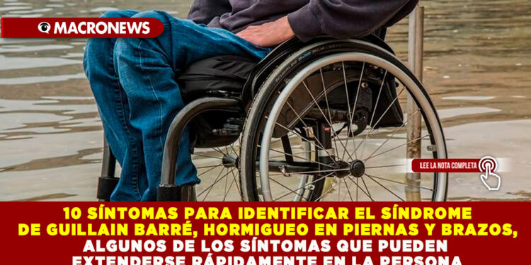 10 SÍNTOMAS PARA IDENTIFICAR EL SÍNDROME DE GUILLAIN BARRÉ, HORMIGUEO EN PIERNAS Y BRAZOS, ALGUNOS DE LOS SÍNTOMAS QUE PUEDEN EXTENDERSE RÁPIDAMENTE EN LA PERSONA