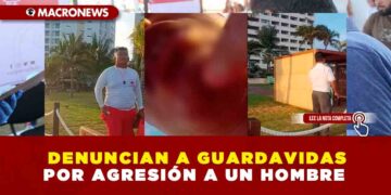 DENUNCIAN A GUARDAVIDAS POR AGRESIÓN A UN HOMBRE