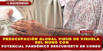 PREOCUPACIÓN GLOBAL VIRUS DE VIRUELA DEL MONO CON POTENCIAL PANDÉMICO DESCUBIERTO EN CONGO
