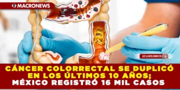 CÁNCER COLORRECTAL SE DUPLICÓ EN LOS ÚLTIMOS 10 AÑOS; MÉXICO REGISTRÓ 16 MIL CASOS