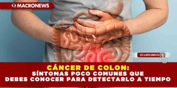 CÁNCER DE COLON: SÍNTOMAS POCO COMUNES QUE DEBES CONOCER PARA DETECTARLO A TIEMPO
