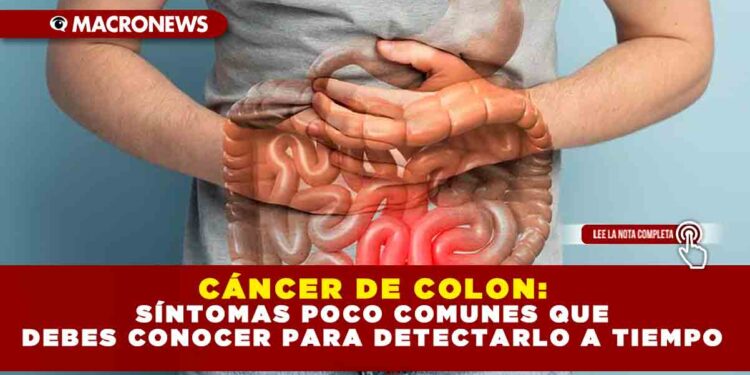 CÁNCER DE COLON: SÍNTOMAS POCO COMUNES QUE DEBES CONOCER PARA DETECTARLO A TIEMPO