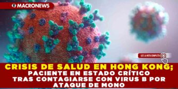 CRISIS DE SALUD EN HONG KONG; PACIENTE EN ESTADO CRÍTICO TRAS CONTAGIARSE CON VIRUS B POR ATAQUE DE MONO