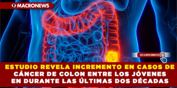 ESTUDIO REVELA INCREMENTO EN CASOS DE CÁNCER DE COLON ENTRE LOS JÓVENES EN DURANTE LAS ÚLTIMAS DOS DÉCADAS