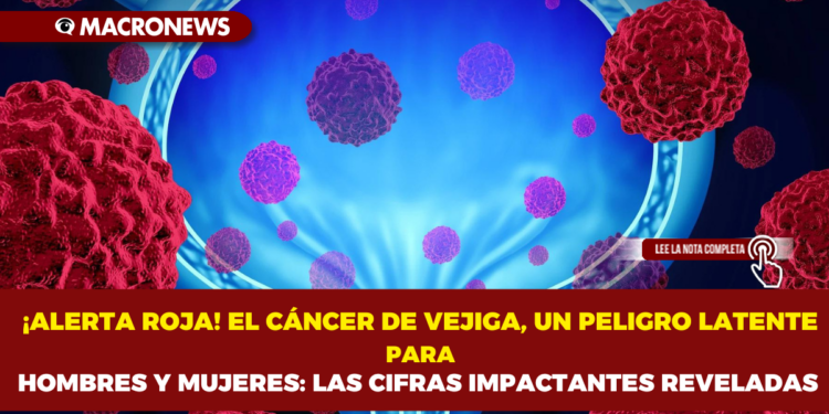 ¡ALERTA ROJA!EL CÁNCER DE VEJIGA, UN PELIGRO LATENTE PARA HOMBRES Y MUJERES: ¡LAS CIFRAS IMPACTANTES REVELADAS!