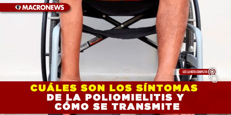 CUÁLES SON LOS SÍNTOMAS DE LA POLIOMIELITIS Y CÓMO SE TRANSMITE