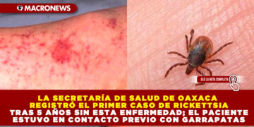 LA SECRETARÍA DE SALUD DE OAXACA REGISTRÓ EL PRIMER CASO DE RICKETTSIA TRAS 5 AÑOS SIN ESTA ENFERMEDAD; EL PACIENTE ESTUVO EN CONTACTO PREVIO CON GARRAPATAS