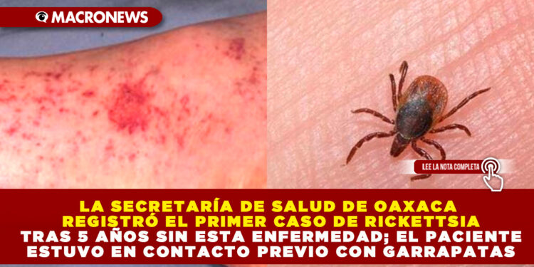 LA SECRETARÍA DE SALUD DE OAXACA REGISTRÓ EL PRIMER CASO DE RICKETTSIA TRAS 5 AÑOS SIN ESTA ENFERMEDAD; EL PACIENTE ESTUVO EN CONTACTO PREVIO CON GARRAPATAS
