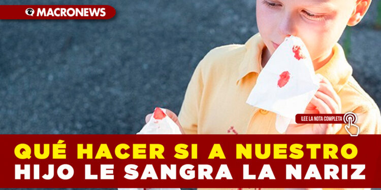 QUÉ HACER SI A NUESTRO HIJO LE SANGRA LA NARIZ