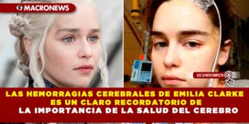 LAS HEMORRAGIAS CEREBRALES DE EMILIA CLARKE ES UN CLARO RECORDATORIO DE LA IMPORTANCIA DE LA SALUD DEL CEREBRO