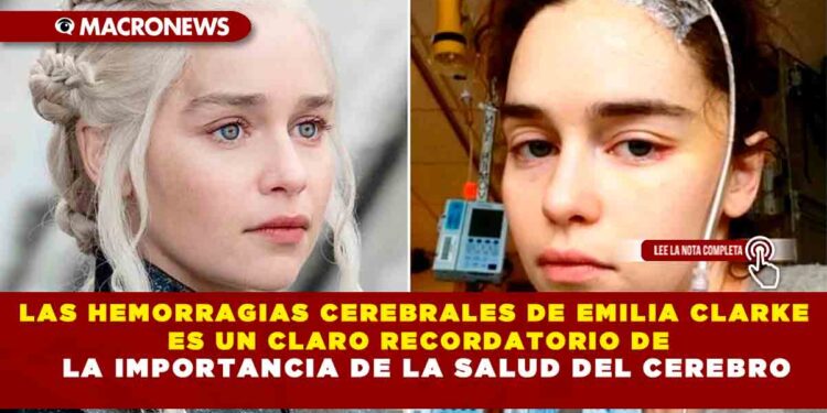 LAS HEMORRAGIAS CEREBRALES DE EMILIA CLARKE ES UN CLARO RECORDATORIO DE LA IMPORTANCIA DE LA SALUD DEL CEREBRO