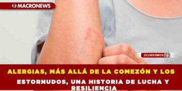 ALERGIAS, MÁS ALLÁ DE LA COMEZÓN Y LOS ESTORNUDOS, UNA HISTORIA DE LUCHA Y RESILIENCIA
