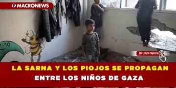 LA SARNA Y LOS PIOJOS SE PROPAGAN ENTRE LOS NIÑOS DE GAZA