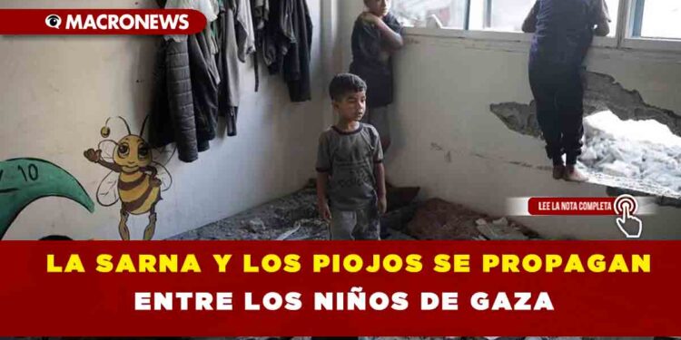 LA SARNA Y LOS PIOJOS SE PROPAGAN ENTRE LOS NIÑOS DE GAZA