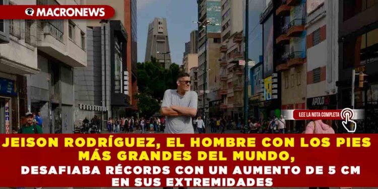 JEISON RODRÍGUEZ, EL HOMBRE CON LOS PIES MÁS GRANDES DEL MUNDO, DESAFIABA RÉCORDS CON UN AUMENTO DE 5CM EN SUS EXTREMIDADES