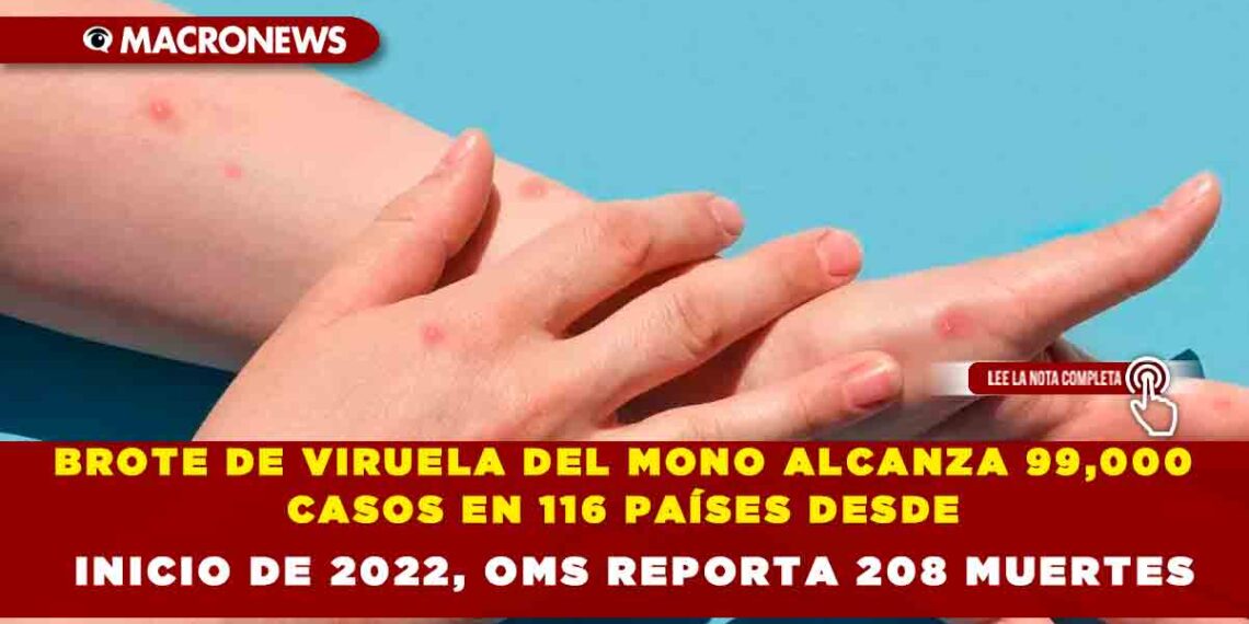 BROTE DE VIRUELA DEL MONO ALCANZA 99,000 CASOS EN 116 PAÍSES DESDE INICIO DE 2022, OMS REPORTA 208 MUERTES