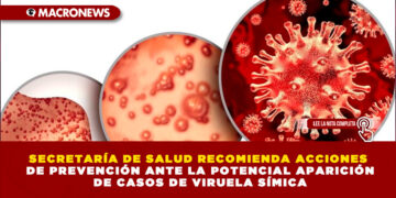SECRETARÍA DE SALUD RECOMIENDA ACCIONES DE PREVENCIÓN ANTE LA POTENCIAL APARICIÓN DE CASOS DE VIRUELA SÍMICA