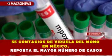 55 CONTAGIOS DE VIRUELA DEL MONO EN MÉXICO, REPORTA EL MAYOR NÚMERO DE CASOS