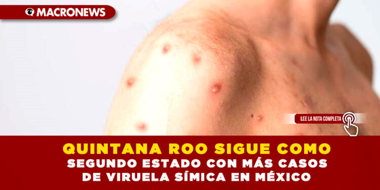 QUINTANA ROO SIGUE COMO SEGUNDO ESTADO CON MÁS CASOS DE VIRUELA SÍMICA EN MÉXICO