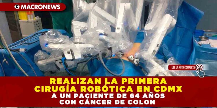REALIZAN LA PRIMERA CIRUGÍA ROBÓTICA EN CDMX A UN PACIENTE DE 64 AÑOS CON CÁNCER DE COLON