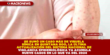 SE SUMÓ UN CASO MÁS DE VIRUELA SÍMICA EN QUINTANA ROO, LA ÚLTIMA ACTUALIZACIÓN DEL SISTEMA NACIONAL DE VIGILANCIA EPIDEMIOLÓGICA YA ACUMULA NUEVE CASOS EN LO QUE VA DEL 2024