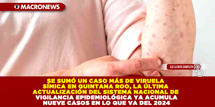 SE SUMÓ UN CASO MÁS DE VIRUELA SÍMICA EN QUINTANA ROO, LA ÚLTIMA ACTUALIZACIÓN DEL SISTEMA NACIONAL DE VIGILANCIA EPIDEMIOLÓGICA YA ACUMULA NUEVE CASOS EN LO QUE VA DEL 2024