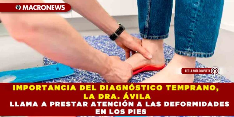 IMPORTANCIA DEL DIAGNÓSTICO TEMPRANO, LA DRA. ÁVILA LLAMA A PRESTAR ATENCIÓN A LAS DEFORMIDADES EN LOS PIES