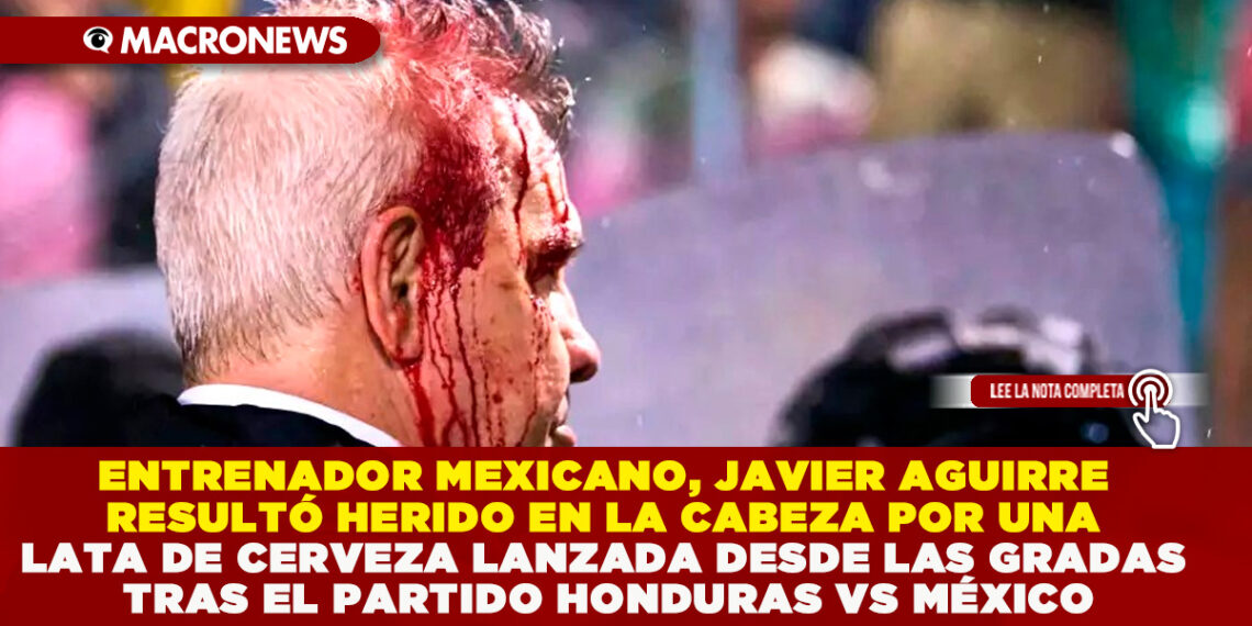 ENTRENADOR MEXICANO, JAVIER AGUIRRE RESULTÓ HERIDO EN LA CABEZA POR UNA LATA DE CERVEZA LANZADA DESDE LAS GRADAS TRAS EL PARTIDO HONDURAS VS MÉXICO