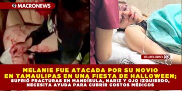 MELANIE FUE ATACADA POR SU NOVIO EN TAMAULIPAS EN UNA FIESTA DE HALLOWEEN; SUFRIÓ FRACTURAS EN MANDÍBULA, NARIZ Y OJO IZQUIERDO, NECESITA AYUDA PARA CUBRIR COSTOS MÉDICOS