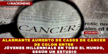 ALARMANTE AUMENTO DE CASOS DE CÁNCER DE COLON ENTRE JÓVENES MILLENNIALS EN TODO EL MUNDO, SEGÚN UN ESTUDIO