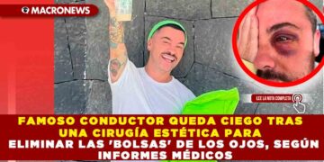 FAMOSO CONDUCTOR QUEDA CIEGO TRAS UNA CIRUGÍA ESTÉTICA PARA ELIMINAR LAS ‘BOLSAS’ DE LOS OJOS, SEGÚN INFORMES MÉDICOS
