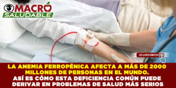 LA ANEMIA FERROPÉNICA AFECTA A MÁS DE 2000 MILLONES DE PERSONAS EN EL MUNDO. ASÍ ES CÓMO ESTA DEFICIENCIA COMÚN PUEDE DERIVAR EN PROBLEMAS DE SALUD MÁS SERIOS