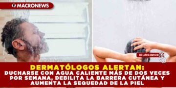 DERMATÓLOGOS ALERTAN: DUCHARSE CON AGUA CALIENTE MÁS DE DOS VECES POR SEMANA, DEBILITA LA BARRERA CUTÁNEA Y AUMENTA LA SEQUEDAD DE LA PIEL