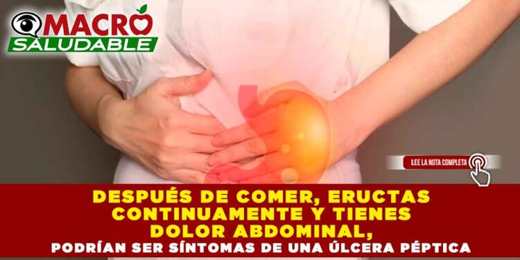 DESPUÉS DE COMER, ERUCTAS CONTINUAMENTE Y TIENES DOLOR ABDOMINAL, PODRÍAN SER SÍNTOMAS DE UNA ÚLCERA PÉPTICA