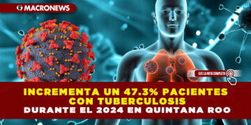 INCREMENTA UN 47.3% PACIENTES CON TUBERCULOSIS DURANTE EL 2024 EN QUINTANA ROO