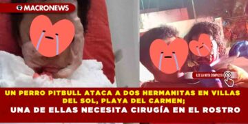 UN PERRO PITBULL ATACA A DOS HERMANITAS EN VILLAS DEL SOL, PLAYA DEL CARMEN; UNA DE ELLAS NECESITA CIRUGÍA EN EL ROSTRO