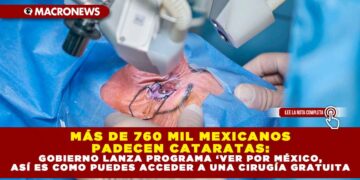 MÁS DE 760 MIL MEXICANOS PADECEN CATARATAS: GOBIERNO LANZA PROGRAMA ‘VER POR MÉXICO, ASÍ ES COMO PUEDES ACCEDER A UNA CIRUGÍA GRATUITA